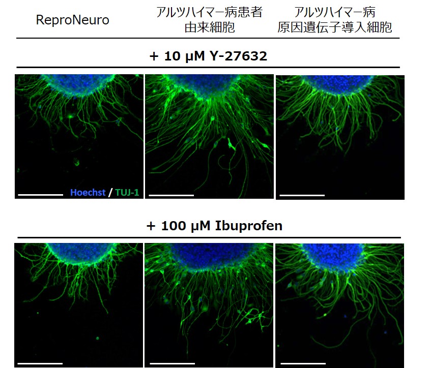 neurosphere