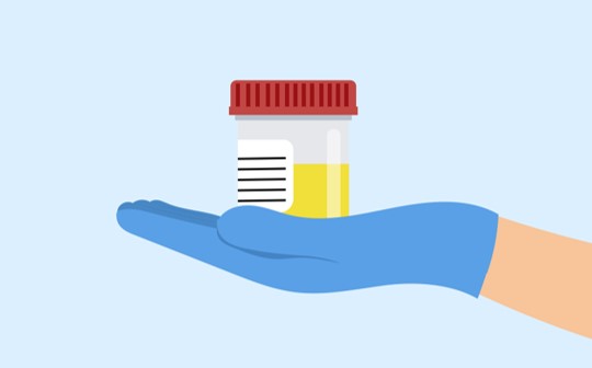 iPS細胞をつくれる細胞とつくれない細胞「尿からiPS細胞をつくれるのはなぜ?」