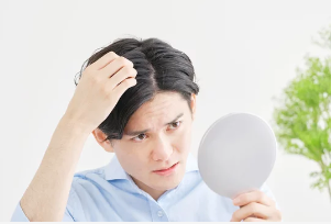 【男性型脱毛症（AGA）】薄毛の原因と治療法を詳しく解説！