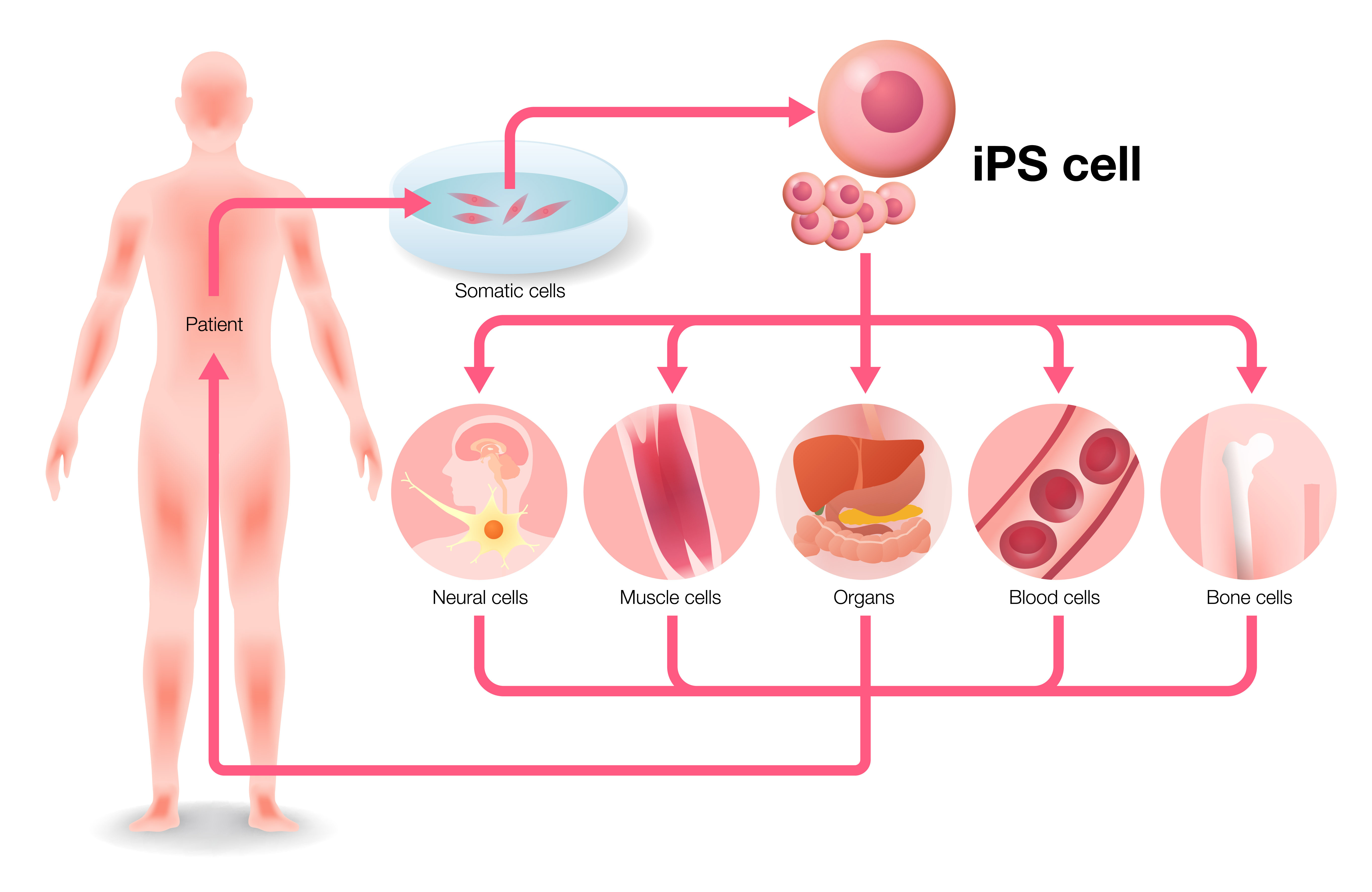Ips細胞について Ir情報 株式会社リプロセル