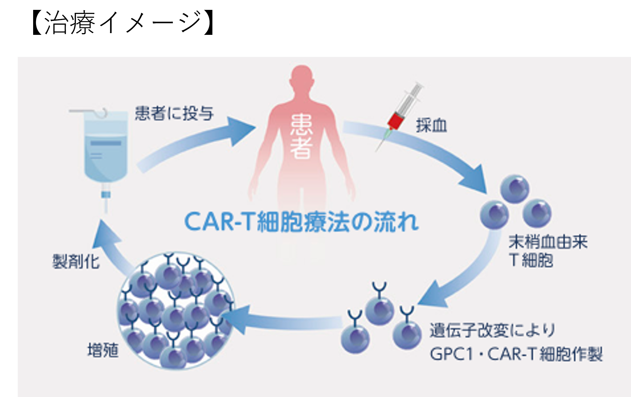 扁平上皮がん・GPC1 CAR-T - 株式会社リプロセル