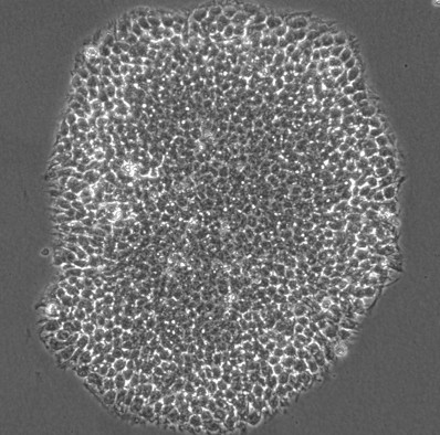 HLAノックアウトiPS細胞｜ユニーバーサルドナーセル｜B2M/CIITAダブルノックアウト｜再生医療・創薬研究